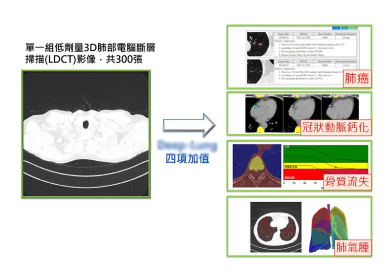 照1次電腦斷層、預測4種疾病！北醫開發AI篩檢系統：準確率高達9成