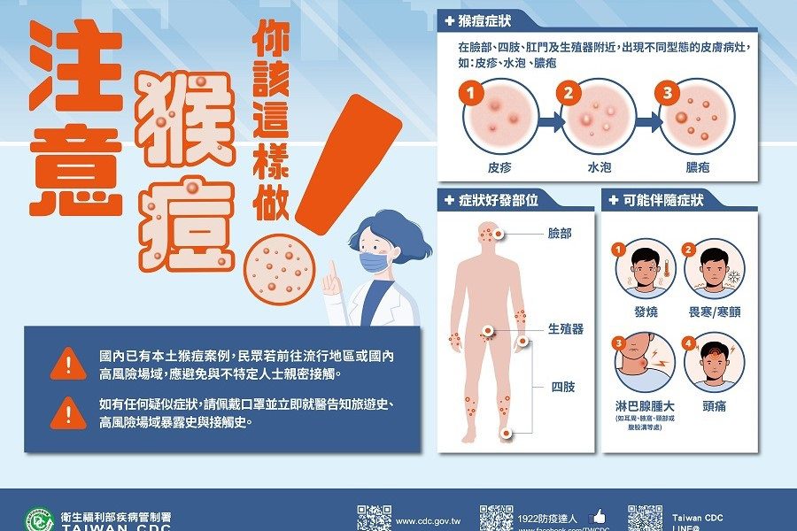 本土猴痘病例增18例　北部9例最多、東部也出現病例