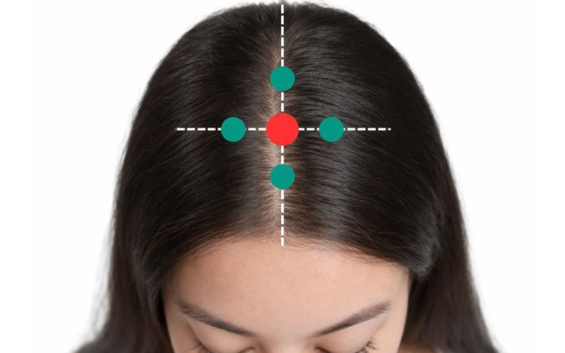 64歲婦人失眠7年難入睡　中醫疏肝理氣助一覺到天亮