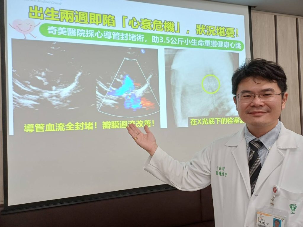 出生兩週新生兒心雜音 心導管封堵術 助小生命重獲健康心跳