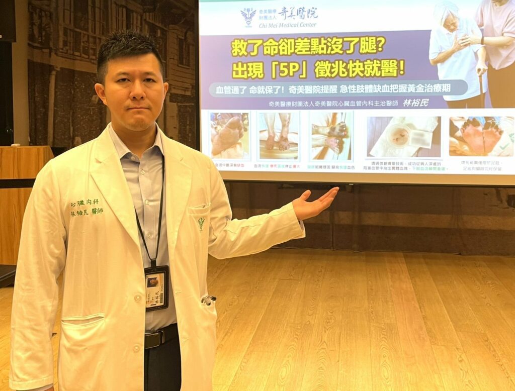 36歲女心臟手術後雙腿發紫脈搏消失？奇美醫院採微創導管疏通血管救回行走能力