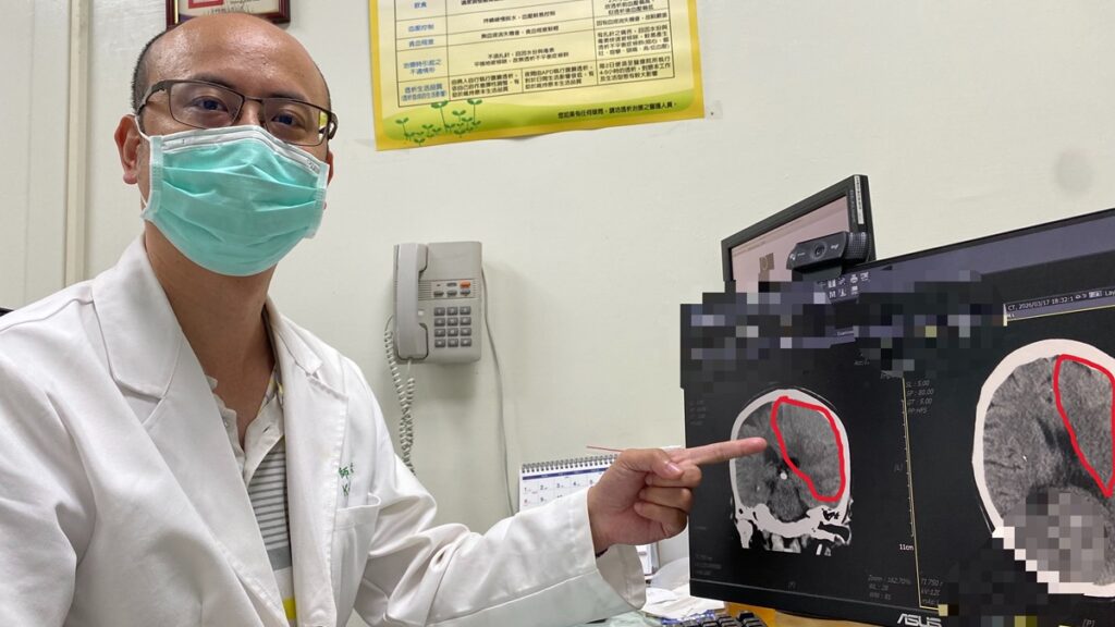原要換膝關節竟變「緊急開腦」  員榮跨科團隊及時攔截隱形殺手