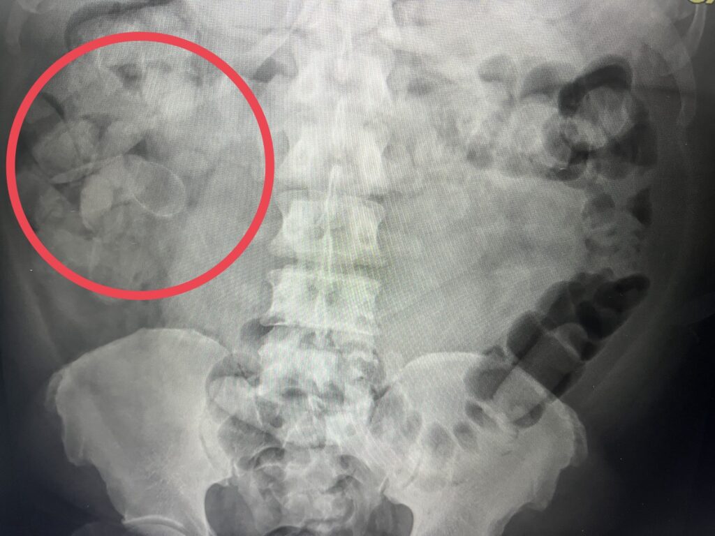 【明如鏡、察秋毫、靖邊關】橋檢指揮跨轄聯手，桃機截法男排出1.4公斤一級毒