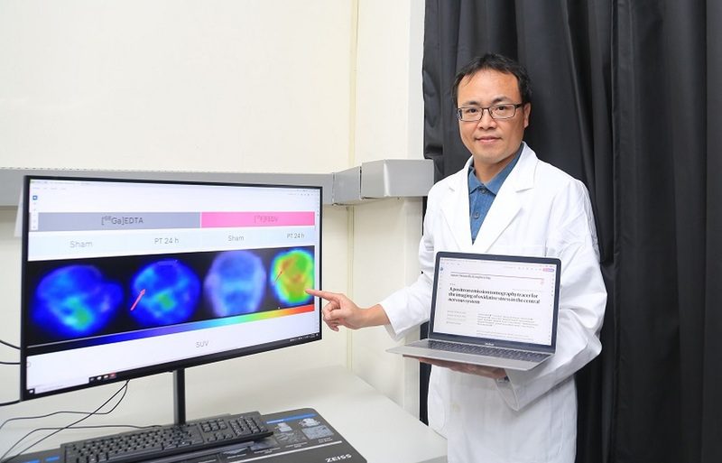 全球首創氧化壓力偵測技術　中山大學研究有望緩解阿茲海默症