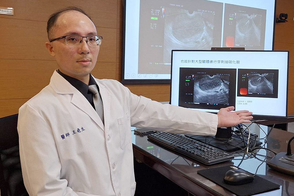【胰臟囊腫 Pancreatic Cyst】不是癌　及早發現、妥善追蹤，預防惡化