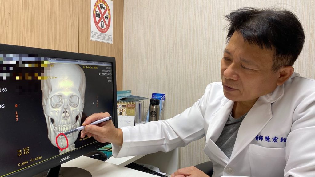 兩歲孩往媽媽鼻子一撞鼻骨竟斷了  醫師呼籲：顏面受傷把握黃金治療期